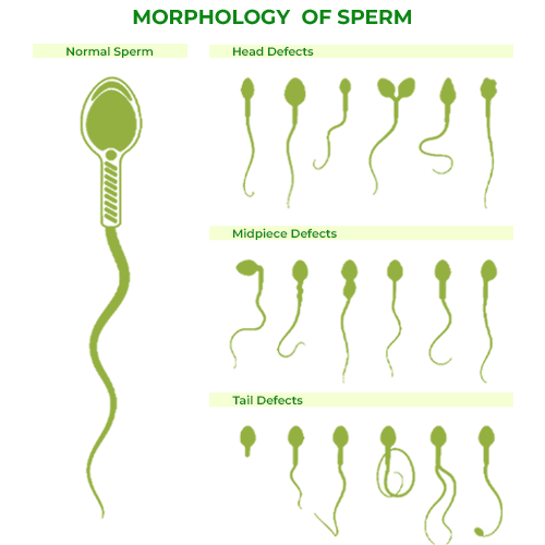 Morphology of Sperm