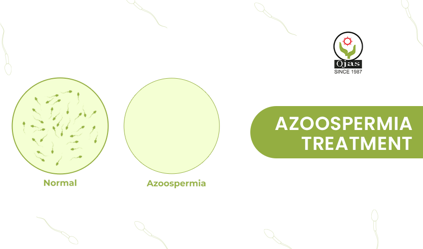 azoospermia treatment