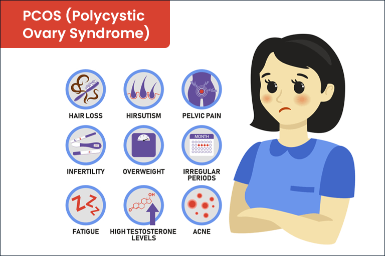 Common symptoms of (PCOS) 